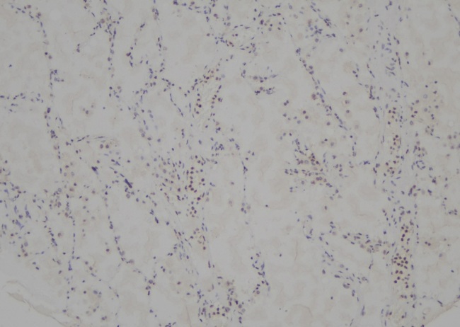 DDIT3 / CHOP Antibody - 1:100 staining human lung tissue by IHC-P. The sample was formaldehyde fixed and a heat mediated antigen retrieval step in citrate buffer was performed. The sample was then blocked and incubated with the antibody for 1.5 hours at 22°C. An HRP conjugated goat anti-rabbit antibody was used as the secondary.