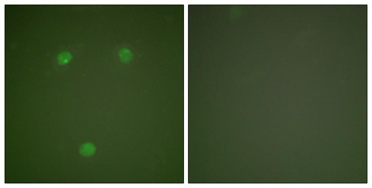 DDIT3 / CHOP Antibody - Peptide - + Immunofluorescence analysis of COS7 cells, using GADD153 antibody.