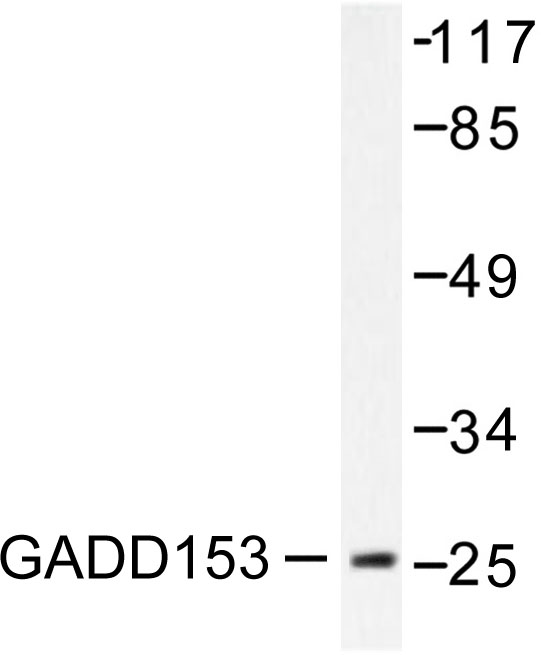 DDIT3 / CHOP Antibody - Western blot of GADD153 (K121) pAb in extracts from LOVO treated with serum 10% 15' cells.