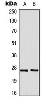 DDIT3 / CHOP Antibody - Western blot analysis of GADD153 expression in Jurkat (A); HeLa (B) whole cell lysates.