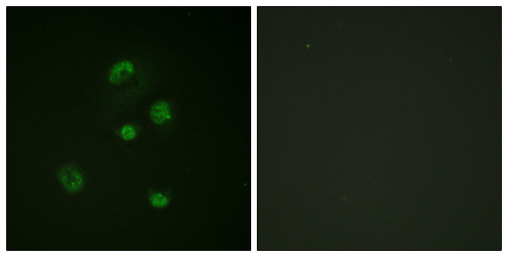 DDIT3 / CHOP Antibody - Immunofluorescence analysis of A549 cells, using CHOP (Phospho-Ser30) Antibody. The picture on the right is blocked with the phospho peptide.