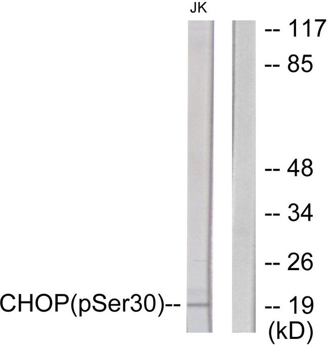 DDIT3 / CHOP Antibody - Western blot analysis of lysates from Jurkat cells treated with PMA 125ng/ml 30', using CHOP (Phospho-Ser30) Antibody. The lane on the right is blocked with the phospho peptide.