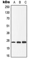 DDIT3 / CHOP Antibody - Western blot analysis of GADD153 (pS30) expression in HeLa (A); Raw264.7 (B); rat spleen (C) whole cell lysates.