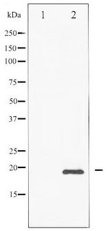 DDIT3 / CHOP Antibody - Western blot of CHOP phosphorylation expression in PMA treated Jurkat whole cell lysates,The lane on the left is treated with the antigen-specific peptide.