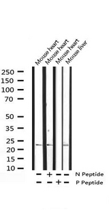 DDIT3 / CHOP Antibody - Western blot analysis of Phospho-CHOP (Ser30) expression in various lysates