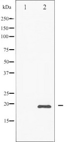 DDIT3 / CHOP Antibody - Western blot analysis of CHOP phosphorylation expression in PMA treated Jurkat whole cells lysates. The lane on the left is treated with the antigen-specific peptide.