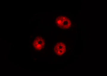DDIT3 / CHOP Antibody - Staining HeLa cells by IF/ICC. The samples were fixed with PFA and permeabilized in 0.1% Triton X-100, then blocked in 10% serum for 45 min at 25°C. The primary antibody was diluted at 1:200 and incubated with the sample for 1 hour at 37°C. An Alexa Fluor 594 conjugated goat anti-rabbit IgG (H+L) Ab, diluted at 1/600, was used as the secondary antibody.