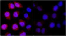 DDIT4 / REDD1 Antibody - Detection of Human REDD1 by Immunocytochemistry. Sample: NBF-fixed asynchronous HeLa cells. Cobalt treated cells (left) or mock treated cells (right) immunostained for REDD1. Antibody: Affinity purified rabbit anti-REDD1 used at a dilution of 1:100. Detection: Red-fluorescent goat anti-rabbit IgG H&L cross-adsorbed Antibody DyLight594(A120-601D4) used at a dilution of 1:100.