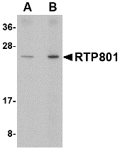 DDIT4 / REDD1 Antibody - Western blot of RTP801 in human kidney tissue lysate with RTP801 antibody at (A) 0.5 and (B) 1 ug/ml.