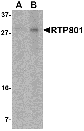 DDIT4 / REDD1 Antibody - Western blot of RTP801 in 293 cell lysate with RTP801 antibody at (A) 2 and (B) 4 ug/ml.