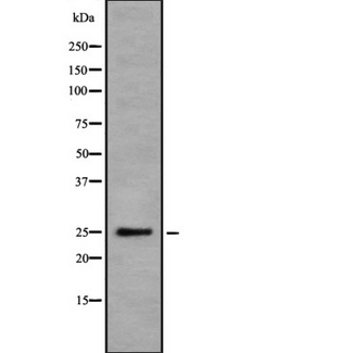 DDIT4 / REDD1 Antibody - Western blot analysis of DDIT4 using Jurkat whole cells lysates