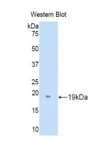 DDO / D-Aspartate Oxidase Antibody - Western blot of recombinant DDO / D-Aspartate Oxidase.  This image was taken for the unconjugated form of this product. Other forms have not been tested.