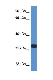 DDO / D-Aspartate Oxidase Antibody - DDO antibody Western blot of Fetal Lung lysate. Antibody concentration 1 ug/ml.  This image was taken for the unconjugated form of this product. Other forms have not been tested.