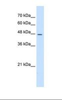 DDOST / OST48 Antibody - Jurkat cell lysate. Antibody concentration: 5.0 ug/ml. Gel concentration: 12%.  This image was taken for the unconjugated form of this product. Other forms have not been tested.