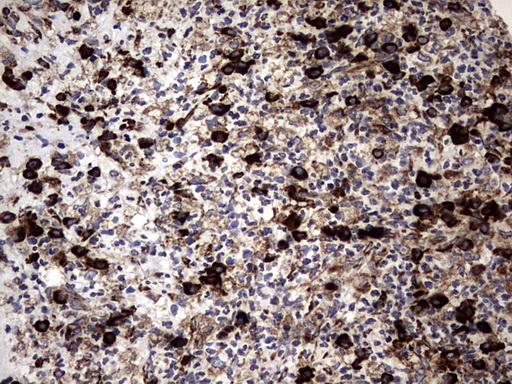 DDOST / OST48 Antibody - IHC of paraffin-embedded Human lymph node tissue using anti-DDOST mouse monoclonal antibody. (heat-induced epitope retrieval by 1 mM EDTA in 10mM Tris, pH8.5, 120°C for 3min).