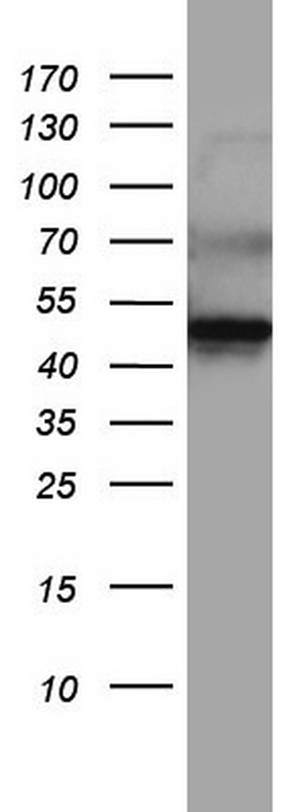 DDOST / OST48 Antibody - Western blot of&#160; A549 cell lysate (35ug) by using anti-DDOST monoclonal antibody.