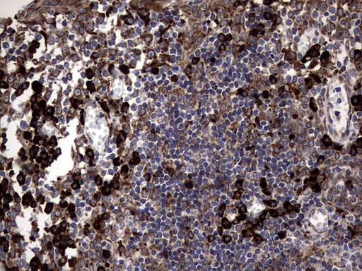 DDOST / OST48 Antibody - IHC of paraffin-embedded Human tonsil using anti-DDOST mouse monoclonal antibody. (heat-induced epitope retrieval by 1 mM EDTA in 10mM Tris, pH8.5, 120°C for 3min).
