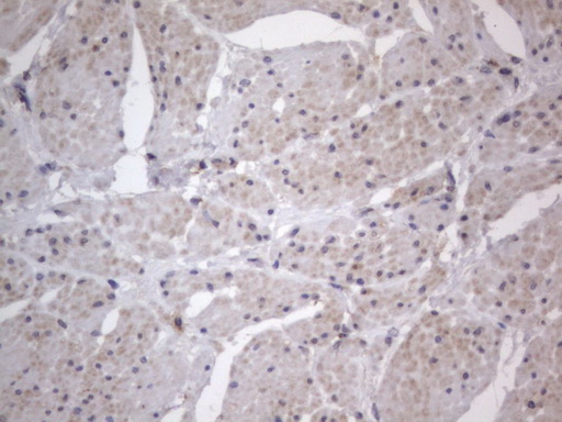 DDOST / OST48 Antibody - IHC of paraffin-embedded Human bladder tissue using anti-DDOST mouse monoclonal antibody. (Heat-induced epitope retrieval by 1 mM EDTA in 10mM Tris, pH8.5, 120°C for 3min).