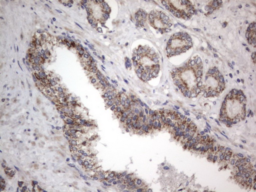 DDOST / OST48 Antibody - IHC of paraffin-embedded Human prostate tissue using anti-DDOST mouse monoclonal antibody. (Heat-induced epitope retrieval by 1 mM EDTA in 10mM Tris, pH8.5, 120°C for 3min).