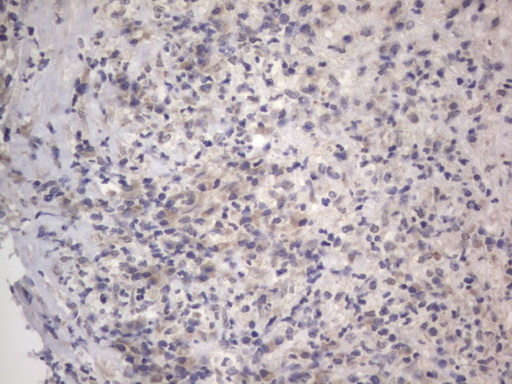 DDOST / OST48 Antibody - IHC of paraffin-embedded Human lymph node tissue using anti-DDOST mouse monoclonal antibody. (Heat-induced epitope retrieval by 1 mM EDTA in 10mM Tris, pH8.5, 120°C for 3min).