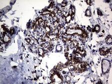 DDOST / OST48 Antibody - IHC of paraffin-embedded Human breast tissue using anti-DDOST mouse monoclonal antibody. (Heat-induced epitope retrieval by 1 mM EDTA in 10mM Tris, pH9.0, 120°C for 3min).