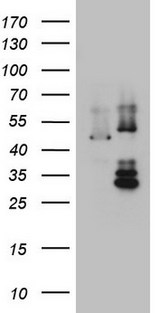 DDOST / OST48 Antibody - HEK293T cells were transfected with the pCMV6-ENTRY control (Left lane) or pCMV6-ENTRY DDOST (Right lane) cDNA for 48 hrs and lysed. Equivalent amounts of cell lysates (5 ug per lane) were separated by SDS-PAGE and immunoblotted with anti-DDOST.