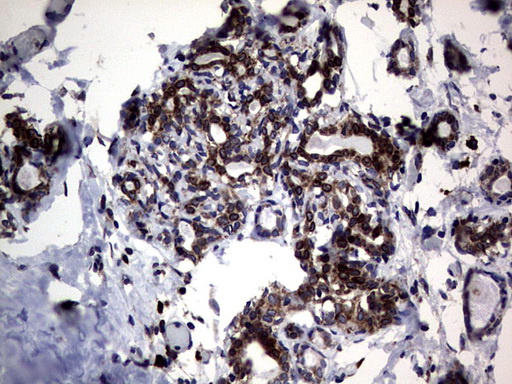 DDOST / OST48 Antibody - IHC of paraffin-embedded Human breast tissue using anti-DDOST mouse monoclonal antibody. (Heat-induced epitope retrieval by 1 mM EDTA in 10mM Tris, pH9.0, 120°C for 3min).