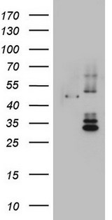 DDOST / OST48 Antibody - HEK293T cells were transfected with the pCMV6-ENTRY control (Left lane) or pCMV6-ENTRY DDOST (Right lane) cDNA for 48 hrs and lysed. Equivalent amounts of cell lysates (5 ug per lane) were separated by SDS-PAGE and immunoblotted with anti-DDOST.