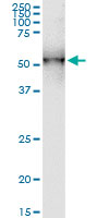 DDOST / OST48 Antibody - DDOST monoclonal antibody (M06), clone 2D7. Western Blot analysis of DDOST expression in human stomach.