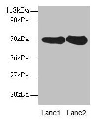 DDOST / OST48 Antibody - Western blot All lanes: Dolichyl-diphosphooligosaccharide--protein glycosyltransferase 48 kDa subunit antibody at 2µg/ml Lane 1: EC109 whole cell lysate Lane 2: 293T whole cell lysate Secondary Goat polyclonal to rabbit IgG at 1/15000 dilution Predicted band size: 50 kDa Observed band size: 50 kDa