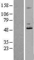 DDOST / OST48 Protein - Western validation with an anti-DDK antibody * L: Control HEK293 lysate R: Over-expression lysate