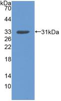 DDR2 Antibody - Western Blot; Sample: Recombinant DDR2, Human.