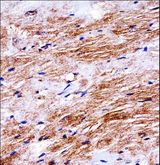 DDR2 Antibody - Mouse Ddr2 Antibody immunohistochemistry of formalin-fixed and paraffin-embedded mouse heart tissue followed by peroxidase-conjugated secondary antibody and DAB staining.
