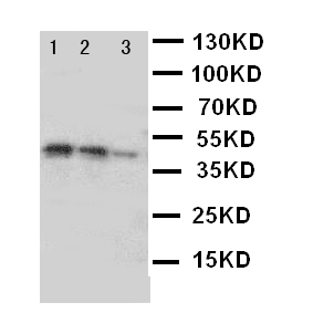 DDR2 Antibody - WB of DDR2 antibody. Recombinant Protein Detection Source:. E.coli derived -recombinant human DDR2, 41.2KD. (162aa tag+Y656-E855). Lane 1: Recombinant Human DDR2 Protein 10ng. Lane 2: Recombinant Human DDR2 Protein 5ng. Lane 3: Recombinant Human DDR2 Protein 2.5ng.