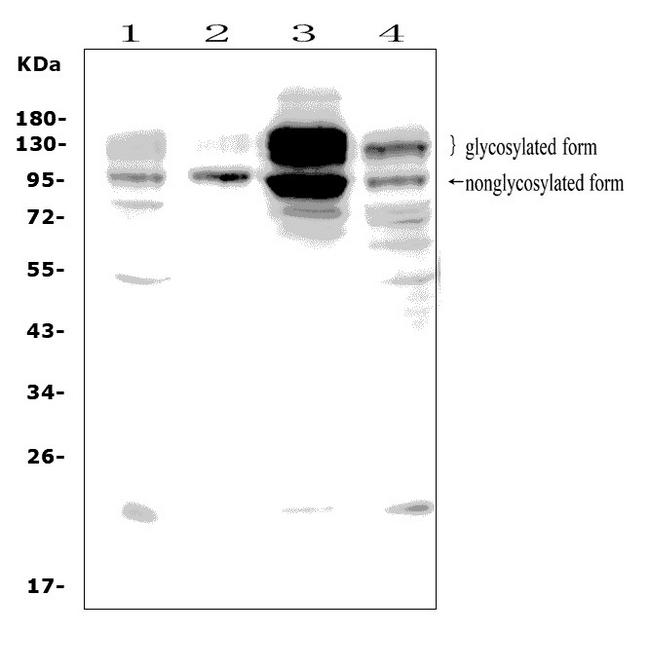 DDR2 Antibody - Western blot analysis of DDR2 using anti-DDR2 antibody. Electrophoresis was performed on a 5-20% SDS-PAGE gel at 70V (Stacking gel) / 90V (Resolving gel) for 2-3 hours. The sample well of each lane was loaded with 50ug of sample under reducing conditions. Lane 1: human HT1080 whole cell lysates, Lane 2: human placenta tissue lysates, Lane 3: human U-87MG whole cell lysates, Lane 4: human U2OS whole cell lysates. After Electrophoresis, proteins were transferred to a Nitrocellulose membrane at 150mA for 50-90 minutes. Blocked the membrane with 5% Non-fat Milk/ TBS for 1.5 hour at RT. The membrane was incubated with rabbit anti-DDR2 antigen affinity purified polyclonal antibody at 0.5 µg/mL overnight at 4°C, then washed with TBS-0.1% Tween 3 times with 5 minutes each and probed with a goat anti-rabbit IgG-HRP secondary antibody at a dilution of 1:10000 for 1.5 hour at RT. The signal is developed using an Enhanced Chemiluminescent detection (ECL) kit with Tanon 5200 system. Specific bands were detected for DDR2 at approximately 97,120-140KD. The expected band size for DDR2 is at 97KD.