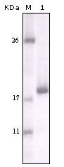 DDR2 Antibody - DDR2 Antibody in Western Blot (WB)