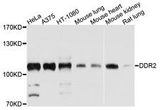 DDR2 Antibody - Western blot analysis of extracts of various cell lines, using DDR2 antibody at 1:1000 dilution. The secondary antibody used was an HRP Goat Anti-Rabbit IgG (H+L) at 1:10000 dilution. Lysates were loaded 25ug per lane and 3% nonfat dry milk in TBST was used for blocking. An ECL Kit was used for detection and the exposure time was 30s.
