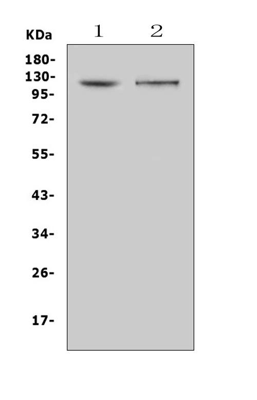 DDR2 Antibody - Western blot analysis of DDR2 using anti-DDR2 antibody. Electrophoresis was performed on a 5-20% SDS-PAGE gel at 70V (Stacking gel) / 90V (Resolving gel) for 2-3 hours. The sample well of each lane was loaded with 50ug of sample under reducing conditions. Lane 1: rat kidney tissue lysates,Lane 2: mouse kidney tissue lysates. After Electrophoresis, proteins were transferred to a Nitrocellulose membrane at 150mA for 50-90 minutes. Blocked the membrane with 5% Non-fat Milk/ TBS for 1.5 hour at RT. The membrane was incubated with rabbit anti-DDR2 antigen affinity purified polyclonal antibody at 0.5 µg/mL overnight at 4°C, then washed with TBS-0.1% Tween 3 times with 5 minutes each and probed with a goat anti-rabbit IgG-HRP secondary antibody at a dilution of 1:10000 for 1.5 hour at RT. The signal is developed using an Enhanced Chemiluminescent detection (ECL) kit with Tanon 5200 system. A specific band was detected for DDR2 at approximately 120KD. The expected band size for DDR2 is at 97KD.