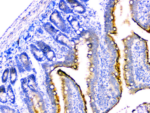 DDR2 Antibody - IHC analysis of DDR2 using anti-DDR2 antibody. DDR2 was detected in paraffin-embedded section of rat small intestine tissue. Heat mediated antigen retrieval was performed in citrate buffer (pH6, epitope retrieval solution) for 20 mins. The tissue section was blocked with 10% goat serum. The tissue section was then incubated with 2µg/ml rabbit anti-DDR2 Antibody overnight at 4°C. Biotinylated goat anti-rabbit IgG was used as secondary antibody and incubated for 30 minutes at 37°C. The tissue section was developed using Strepavidin-Biotin-Complex (SABC) with DAB as the chromogen.