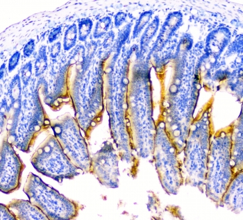 DDR2 Antibody - IHC staining of FFPE mouse small intestine with DDR2 antibody at 2ug/ml. HIER: boil tissue sections in pH6, 10mM citrate buffer, for 10-20 min followed by cooling at RT for 20 min.