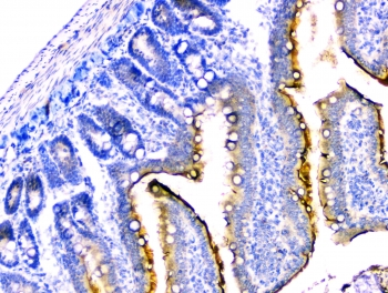 DDR2 Antibody - IHC staining of FFPE rat small intestine with DDR2 antibody at 2ug/ml. HIER: boil tissue sections in pH6, 10mM citrate buffer, for 10-20 min followed by cooling at RT for 20 min.