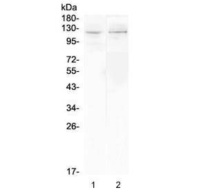 DDR2 Antibody - Western blot testing of 1) rat kidney and 2) mouse kidney lysate with DDR2 antibody at 0.5ug/ml. Predicted molecular weight: 97-116 kDa.