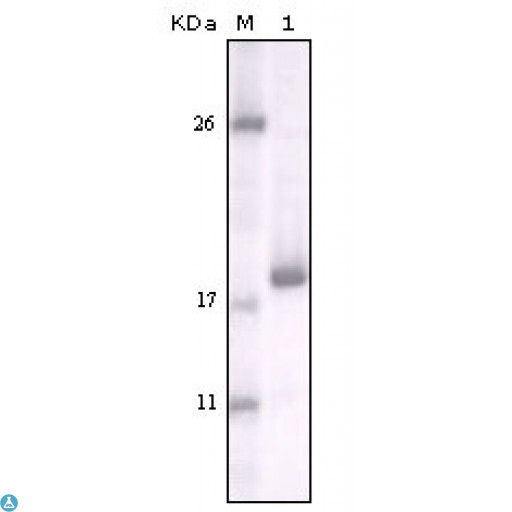 DDR2 Antibody - Western Blot (WB) analysis using DDR2 Monoclonal Antibody against truncated DDR2 recombinant protein.