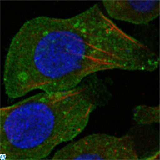 DDR2 Antibody - Confocal Immunofluorescence (IF) analysis of A549 cells using DDR2 Monoclonal Antibody (green). Red: Actin filaments have been labeled with DY-554 phalloidin. Blue: DRAQ5 fluorescent DNA dye.