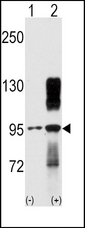 DDR2 Antibody - Western blot of TYRO10 (arrow) using rabbit polyclonal TYRO10 Antibody. 293 cell lysates (2 ug/lane) either nontransfected (Lane 1) or transiently transfected with the DDR2 gene (Lane 2) (Origene Technologies).