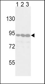 DDR2 Antibody - Western blot of TYRO10 Antibody in Jurkat(lane 1), 293(lane 2) and HeLa(lane 3) cell line lysates (35 ug/lane). TYRO10 (arrow) was detected using the purified antibody.