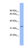 DDRGK1 Antibody - DDRGK1 / C20orf116 antibody Western blot of MCF7 cell lysate. This image was taken for the unconjugated form of this product. Other forms have not been tested.