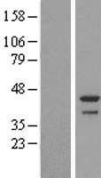 DDRGK1 Protein - Western validation with an anti-DDK antibody * L: Control HEK293 lysate R: Over-expression lysate