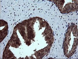 DDT / Dopamine Tautomerase Antibody - IHC of paraffin-embedded Human prostate tissue using anti-DDT mouse monoclonal antibody.