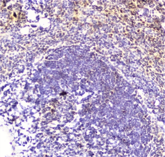 DDT / Dopamine Tautomerase Antibody - IHC analysis of DDT using anti-DDT antibody. DDT was detected in paraffin-embedded section of mouse spleen tissue. Heat mediated antigen retrieval was performed in citrate buffer (pH6, epitope retrieval solution) for 20 mins. The tissue section was blocked with 10% goat serum. The tissue section was then incubated with 2µg/ml rabbit anti-DDT Antibody overnight at 4°C. Biotinylated goat anti-rabbit IgG was used as secondary antibody and incubated for 30 minutes at 37°C. The tissue section was developed using Strepavidin-Biotin-Complex (SABC) with DAB as the chromogen.